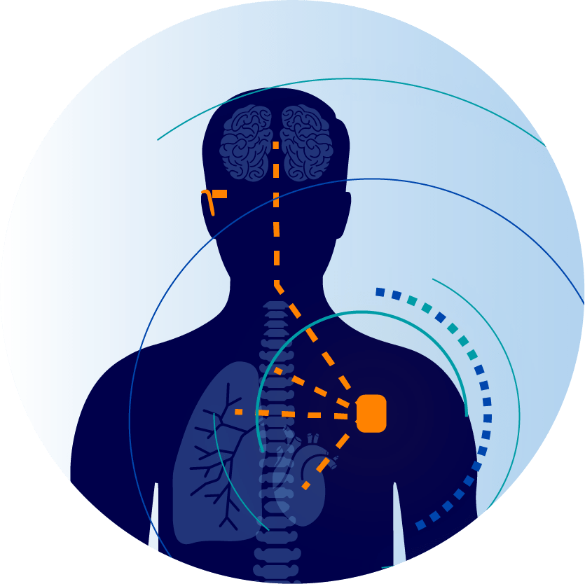 有源植入医疗器械