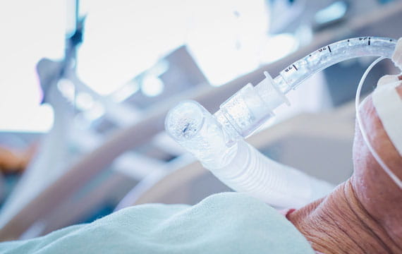 ventilator factory inspection