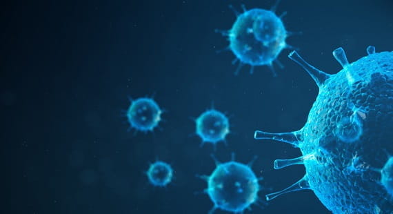 MS Audit rules COVID